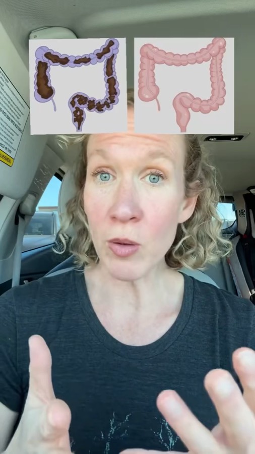 Heather talking to camera in her car below before-and-after illustrations of the colon